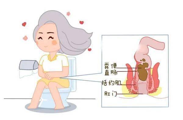 肛门失禁?_肛门失禁手术_肛门失禁图片